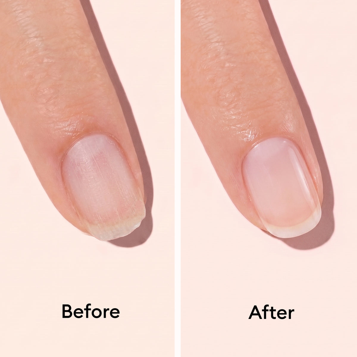 Close-up of a dry, peeling cuticle and damaged nails labeled Before, and smooth, healthy-looking cuticles and nails after using Manucurist Nail Strengthening Serum labeled After.