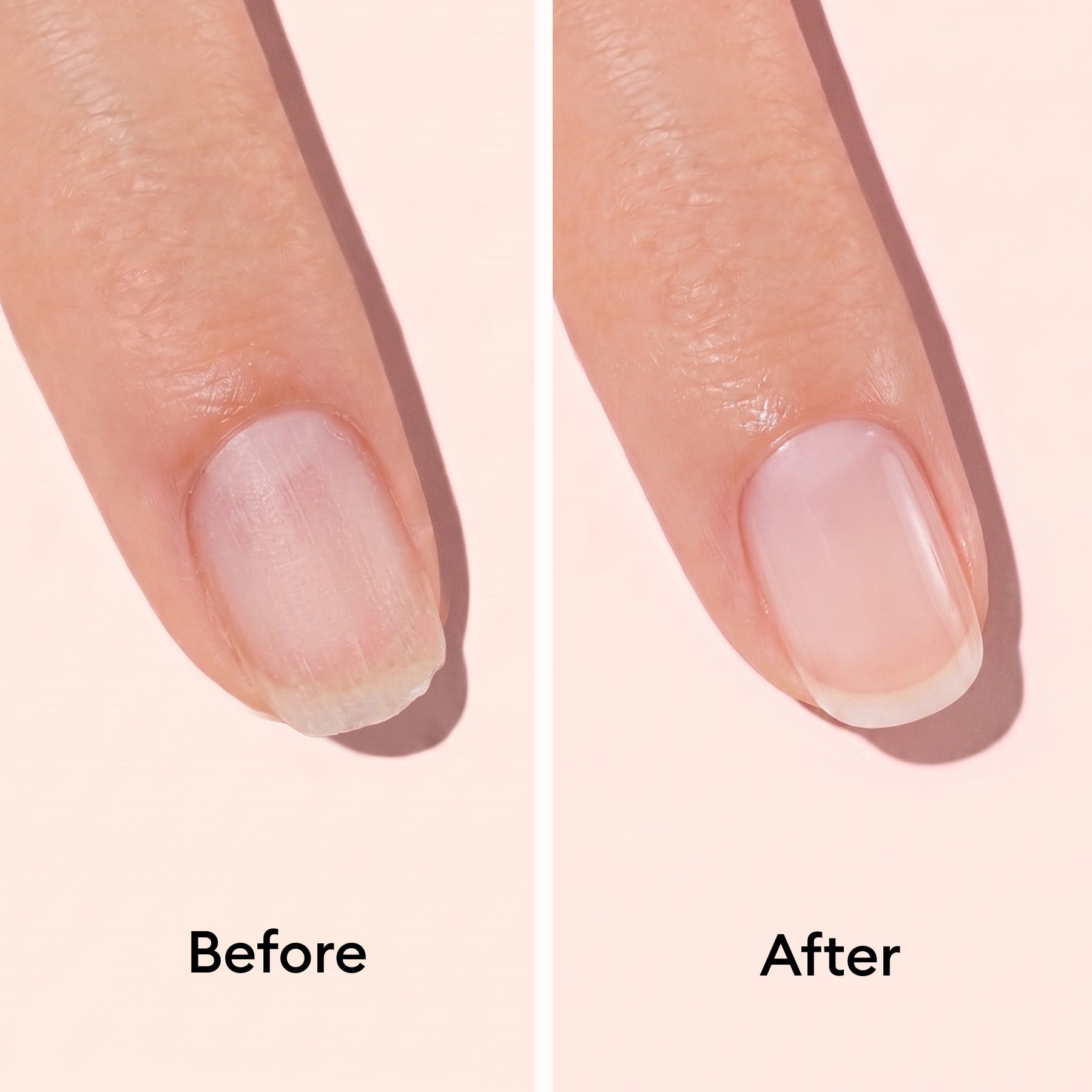 Close-up: a finger with soft, damaged nails and peeling cuticles labeled Before, and a healthy, smooth nail After using Manucurist Day Night Duo.