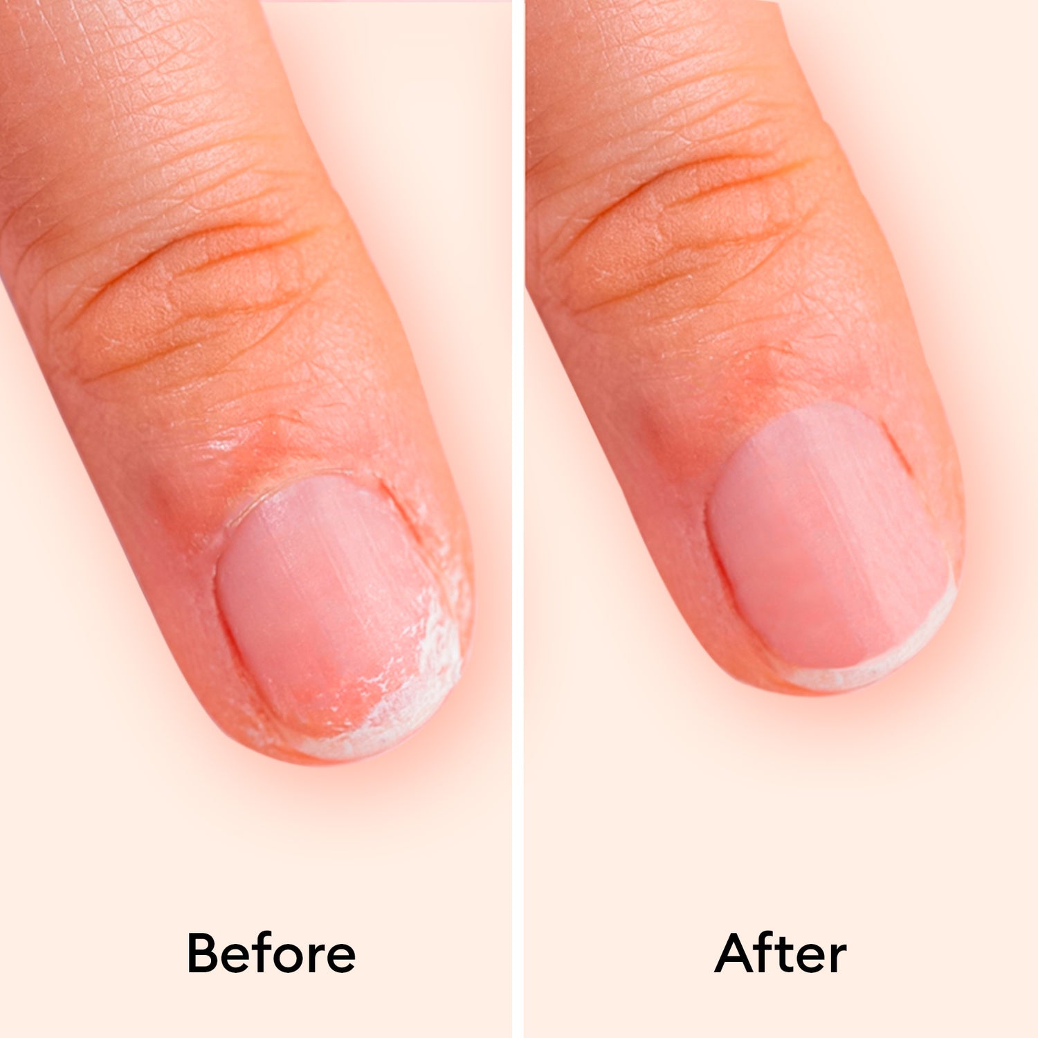 Nail Strengthening Serum